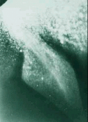The rhomboid fin photograph